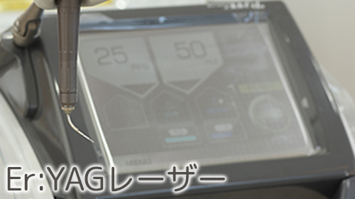 [写真]Er:YAGレーザー