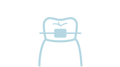 [イラスト]矯正