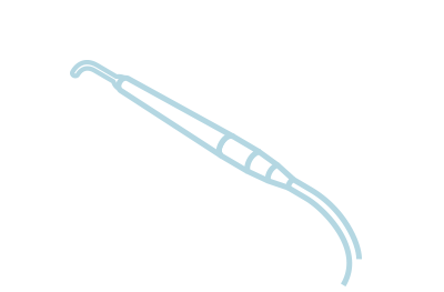 [イラスト]レーザー治療